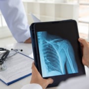 shoulder joint x-ray image on digital tablet with doctor team medical diagnose injuries