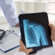 shoulder joint x-ray image on digital tablet with doctor team medical diagnose injuries